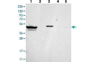 Western blot analysis of Lane 1: RT-4, Lane 2: U-251 MG, Lane 3: Human Plasma, Lane 4: Liver, Lane 5: Tonsil with ZNF774 polyclonal antibody .