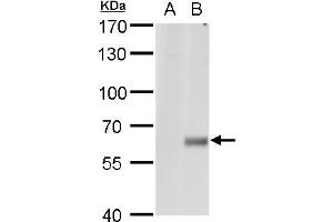 WB Image Copine I antibody [N1N3] detects Copine I protein by western blot analysis. (CPNE1 antibody  (N-Term))