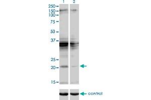 Western blot analysis of SCAND2 over-expressed 293 cell line, cotransfected with SCAND2 Validated Chimera RNAi (Lane 2) or non-transfected control (Lane 1). (SCAND2 antibody  (AA 1-62))