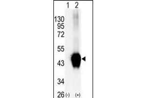 Western blot analysis of BCKDK (arrow) using rabbit polyclonal BCKDK Antibody (C-term ) (R). (BCKDK antibody  (C-Term))