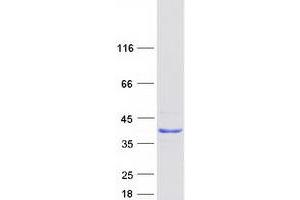 Validation with Western Blot (CXorf26 Protein (Myc-DYKDDDDK Tag))