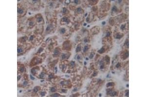 #VALUE! (LRRN1 antibody  (AA 418-631))