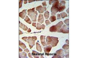 PATL1 Antibody IHC analysis in formalin fixed and paraffin embedded skeletal muscle followed by peroxidase conjugation of the secondary antibody and DAB staining. (PATL1 antibody  (C-Term))