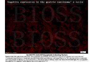 Formalin-fixed and paraffin embedded labeled with human gastric carcinoma Rabbit Anti-AIF Polyclonal Antibody, Unconjugated (ABIN724010) 1:300 followed by conjugation to the secondary antibody Goat Anti-Rabbit IgG, PE (Negative Control) (AIF antibody  (AA 131-230))