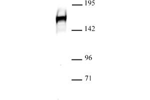 Drosha antibody (pAb) tested by Western blot. (DROSHA antibody  (C-Term))