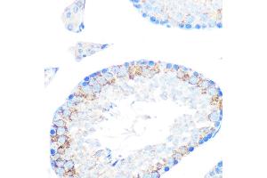 Immunohistochemistry of paraffin-embedded mouse testis using MSR1 Rabbit mAb (ABIN7268353) at dilution of 1:100 (40x lens). (Macrophage Scavenger Receptor 1 antibody)