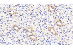 Detection of CTTN in Rat Kidney Tissue using Polyclonal Antibody to Cortactin (CTTN) (Cortactin antibody  (AA 1-509))