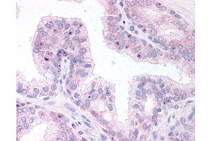 Anti-ERG antibody IHC of human prostate. (ERG antibody  (AA 469-481))