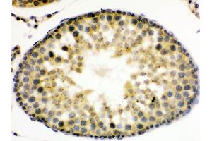 Anti- UPF3B/RENT3B Picoband antibody, IHC(P) IHC(P): Rat Testis Tissue (UPF3B antibody  (C-Term))