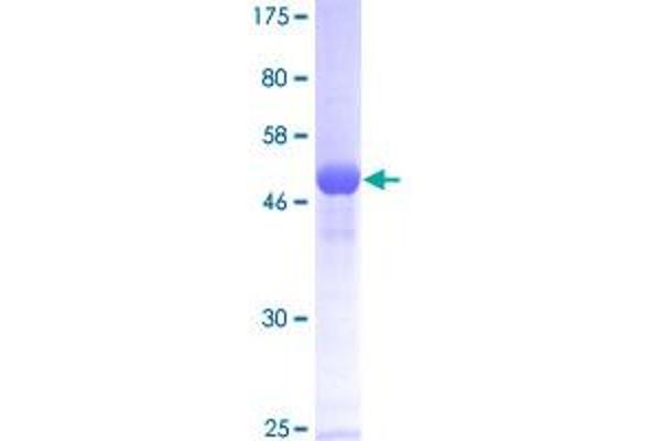 HPRT1 Protein (AA 1-218) (GST tag)