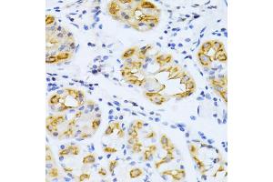 Immunohistochemistry of paraffin-embedded human stomach using CYP2E1 antibody (ABIN5971187) at dilution of 1/100 (40x lens). (CYP2E1 antibody)