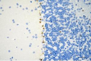 Immunohistochemistry was performed on paraffin-embedded mouse brain using SOX9 antibody (ABIN7800973), 1:200). (Recombinant SRY-Box Transcription Factor 9 antibody)