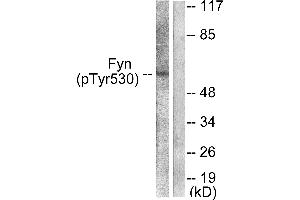 Western blot analysis of extracts from 293 cells, treated with H2O2 (100uM, 15mins), using Fyn (Phospho-Tyr530) antibody (#A0430). (FYN antibody  (pTyr530))