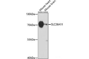 Western blot analysis of extracts of various cell lines using SLC26A11 Polyclonal Antibody at dilution of 1:1000. (SLC26A11 antibody)