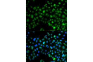 Immunofluorescence analysis of MCF7 cell using NFIL3 antibody. (NFIL3 antibody)