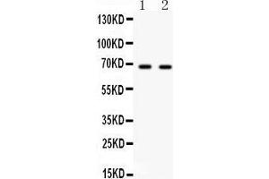 Western Blotting (WB) image for anti-Polo-Like Kinase 1 (PLK1) (AA 86-430) antibody (ABIN3043354) (PLK1 antibody  (AA 86-430))