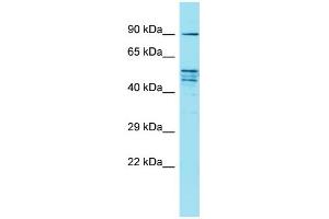 Western Blotting (WB) image for anti-Family with Sequence Similarity 171, Member A2 (FAM171A2) (C-Term) antibody (ABIN2156827) (FAM171A2 antibody  (C-Term))