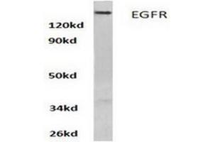 Image no. 1 for anti-Epidermal Growth Factor Receptor (EGFR) antibody (ABIN265397) (EGFR antibody)
