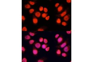 Immunofluorescence analysis of Hela cells using CH antibody (ABIN6127698, ABIN6138485, ABIN6138486 and ABIN6215383) at dilution of 1:100 (40x lens).