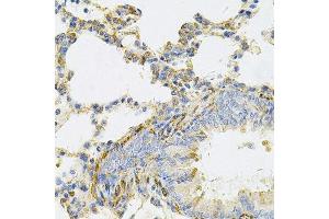 Immunohistochemistry of paraffin-embedded rat lung using UBE2B Antibody. (UBE2B antibody  (AA 1-152))