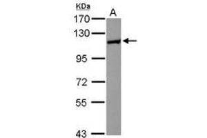 Image no. 2 for anti-Huntingtin Interacting Protein 1 Related (HIP1R) (N-Term) antibody (ABIN1494032) (HIP1R antibody  (N-Term))