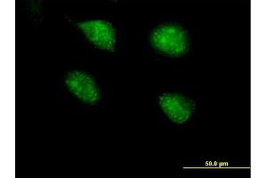 Immunofluorescence of purified MaxPab antibody to PPP2R3B on HeLa cell. (PPP2R3B antibody  (AA 1-176))