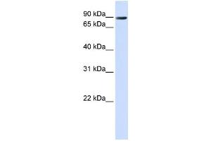 Western Blotting (WB) image for anti-Anoctamin 10 (ANO10) antibody (ABIN2459104) (Anoctamin 10 antibody)
