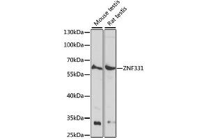 Western blot analysis of extracts of various cell lines, using ZNF331 antibody (ABIN6291097) at 1:1000 dilution. (ZNF331 antibody)