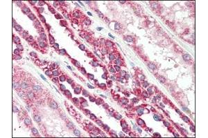 Human Kidney (formalin-fixed, paraffin-embedded) stained with TSPOat 2. (TSPO antibody  (C-Term))