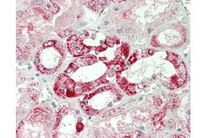 Immunohistochemistry (Paraffin-embedded Sections) (IHC (p)) image for anti-Glutamic-Oxaloacetic Transaminase 2, Mitochondrial (Aspartate Aminotransferase 2) (GOT2) (AA 30-430) antibody (FITC) (ABIN2621445)