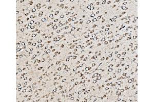 IHC analysis of Kinectin 1/KTN1 using anti-Kinectin 1/KTN1 antibody (ABIN7601096). (KTN1 antibody  (AA 283-827))