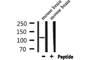 Western blot analysis of extracts from mouse brain, using ZC3H7B Antibody. (ZC3H7B antibody  (C-Term))