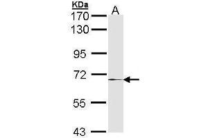 WB Image Sample (30 ug of whole cell lysate) A: Hela 7. (MMP17 antibody)