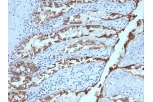 Immunohistochemistry (IHC) image for anti-Epithelial Cell Adhesion Molecule (EPCAM) (AA 77-202), (Extracellular Domain) antibody (ABIN6939979)