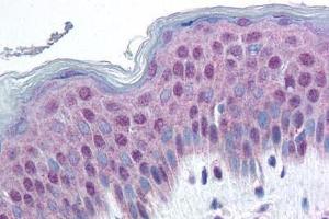 Human Skin (formalin-fixed, paraffin-embedded) stained with HMGN1 antibody ABIN214463 at 20 ug/ml followed by biotinylated goat anti-rabbit IgG secondary antibody ABIN481713, alkaline phosphatase-streptavidin and chromogen. (HMGN1 antibody  (pSer20, Ser24))