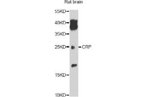 Western blot analysis of extracts of rat brain, using CRP antibody. (CRP antibody)