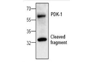 Image no. 1 for anti-3-phosphoinositide Dependent Protein Kinase-1 (PDPK1) antibody (ABIN127128) (PDPK1 antibody)