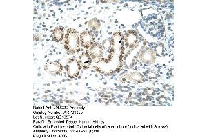 Human kidney (JMJD2D antibody  (C-Term))