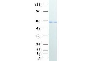 Validation with Western Blot