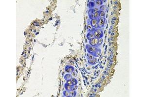 Immunohistochemistry of paraffin-embedded Mouse lung using SKP1 Polyclonal Antibody at dilution of 1:100 (40x lens). (SKP1 antibody)