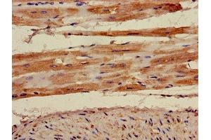 Immunohistochemistry of paraffin-embedded human heart tissue using ABIN7142910 at dilution of 1:100