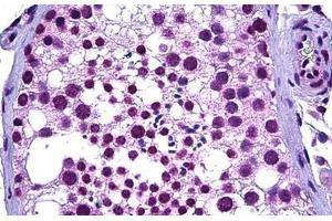 Human Testis: Formalin-Fixed, Paraffin-Embedded (FFPE) (WT1 antibody  (AA 349-439))