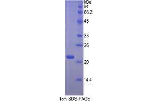 SDS-PAGE analysis of Mouse Hemoglobin beta Protein.