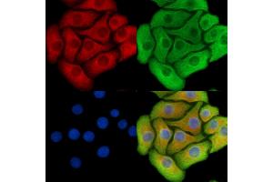 ABIN6260715 and ABIN6278829 staining Hela cells by IF/ICC. (CDK5RAP1 antibody  (C-Term))