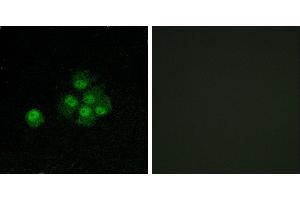 P-peptide - +Immunofluorescence analysis of MCF7 cells, using IRS-1 (Phospho-Ser636) antibody. (IRS1 antibody  (pSer636))