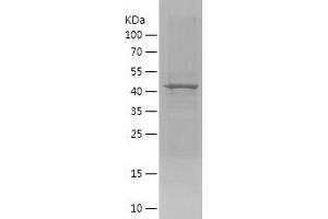 SIM2 Protein (AA 350-550) (His-IF2DI Tag)