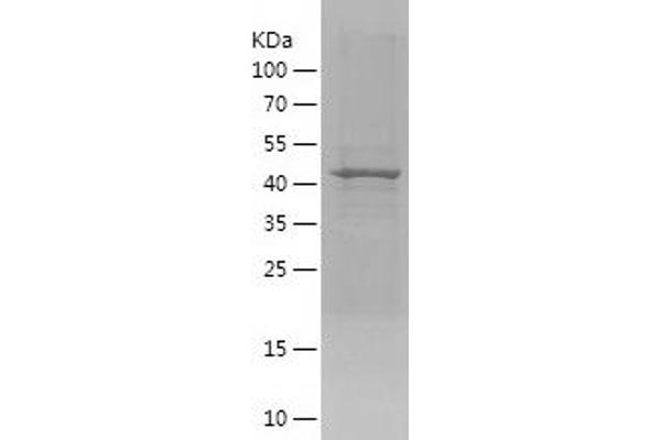 SIM2 Protein (AA 350-550) (His-IF2DI Tag)