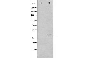 Western blot analysis of BCL-XL phosphorylation expression in UV treated 293 whole cell lysates,The lane on the left is treated with the antigen-specific peptide. (BCL2L1 antibody  (pSer62))