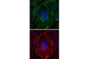 Immunofluorescence analysis of HepG2 cells using ACTA2 monoclonal antibody, clone 4A4  (green).