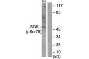 Western blot analysis of extracts from 293 cells treated with UV 15', using SGK (Phospho-Ser78) Antibody. (SGK1 antibody  (pSer78))